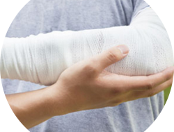 Personal Injury Lawyer Long Island Navigating Your Rights